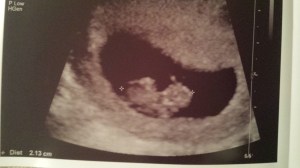 The Cashew at 8 weeks